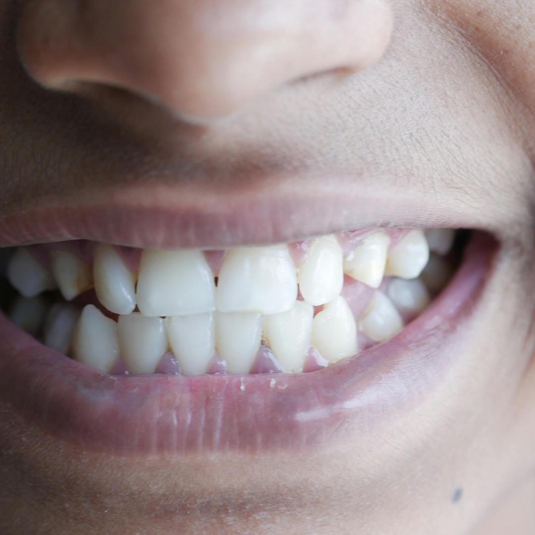 Les dents sont la partie la plus dure du corps humain.