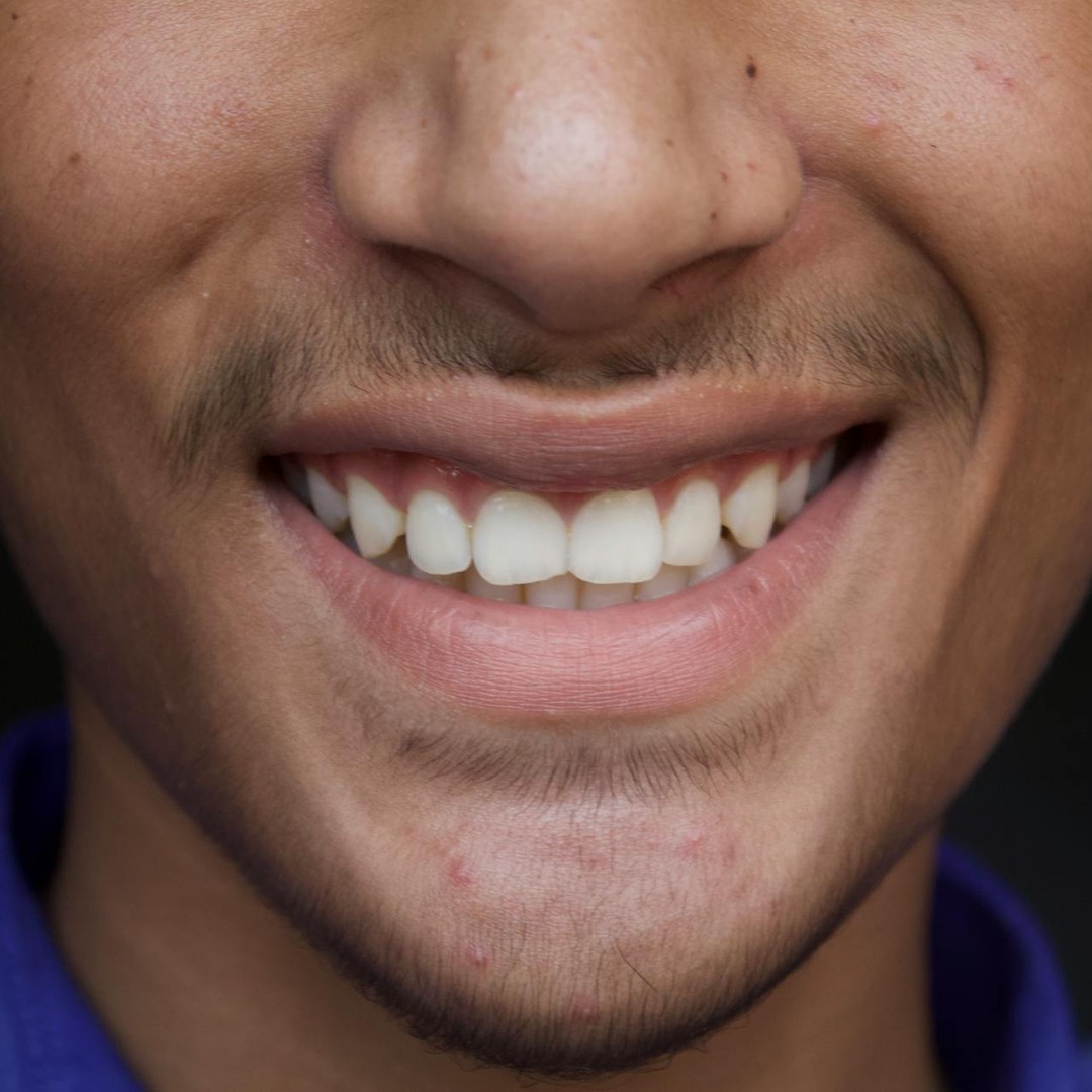 Vos dents sont la seule partie du corps humain qui ne peut pas se guérir d'elle-même.