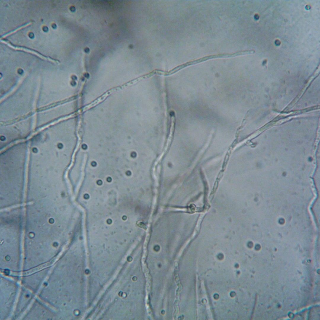 Les cellules gliales sont dix fois plus nombreuses que les neurones dans votre cerveau.