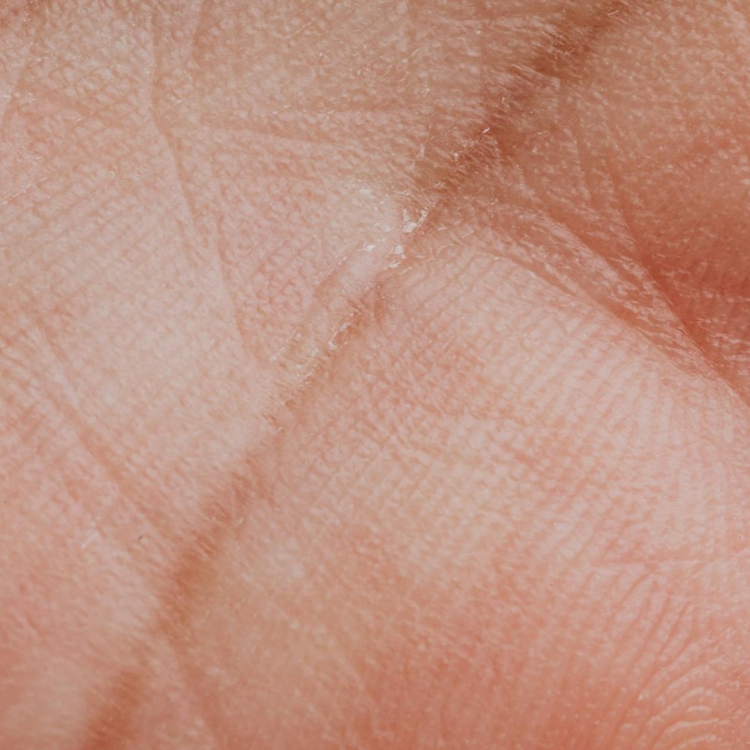 La peau est l'organe le plus lourd du corps humain, pesant environ 4 à 5 kg chez un adulte.