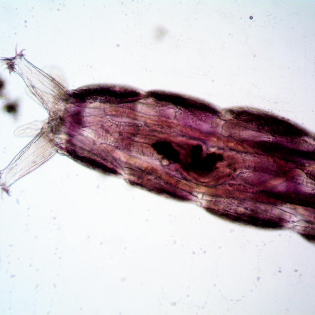 Les tardigrades peuvent survivre au vide spatial en entrant dans un état de dessiccation extrême.