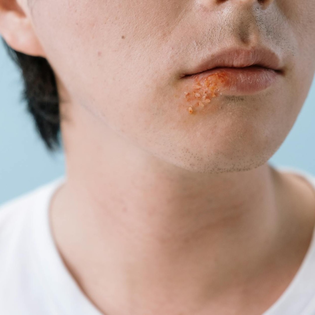 La salive commence la digestion de l'amidon avant même que les aliments arrivent à l'estomac.