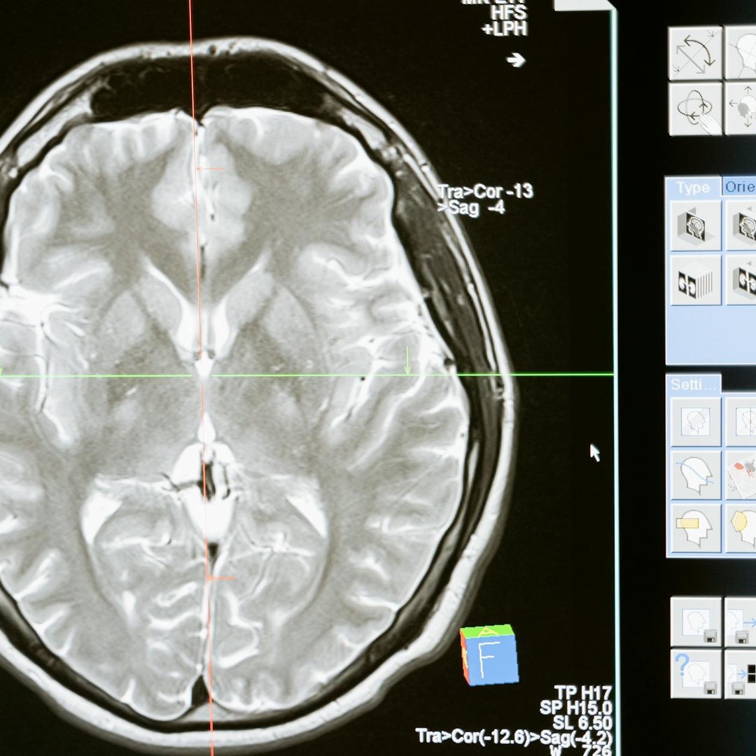 Le cerveau ne commence pas simplement a perdre des neurones a 20 ans : son vieillissement est bien plus complexe.