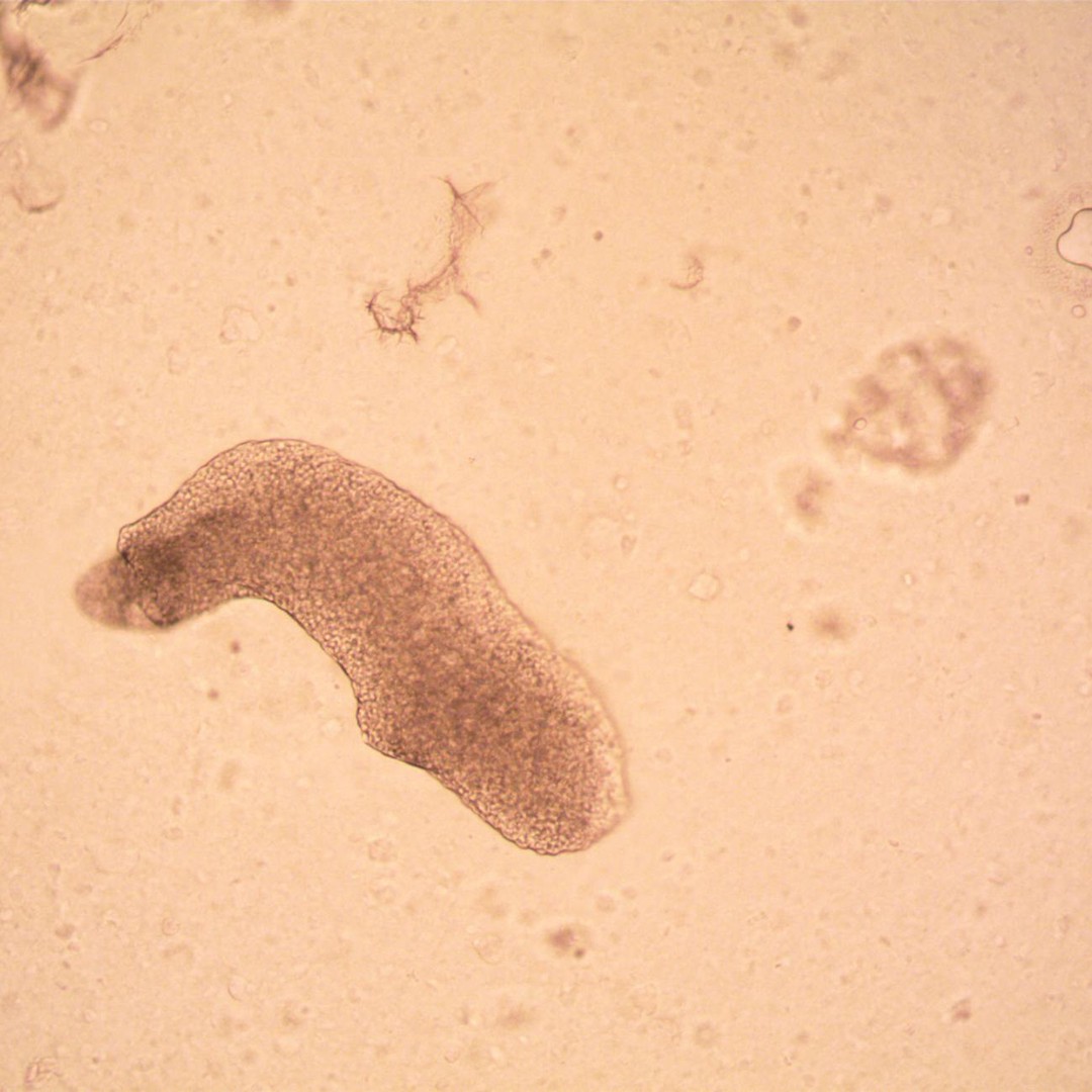 Les tardigrades peuvent survivre au vide spatial.