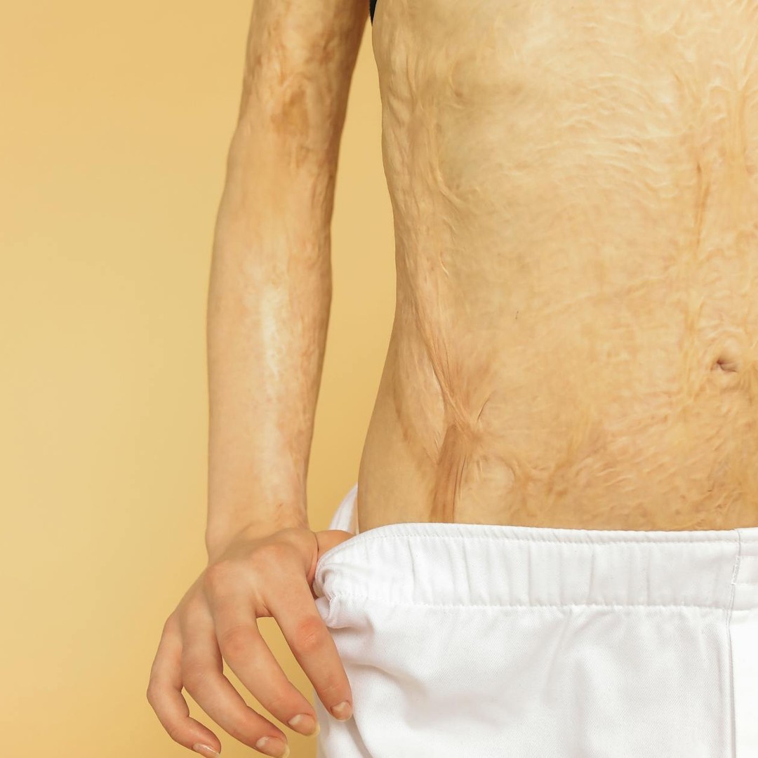 La peau est le plus grand organe du corps humain.